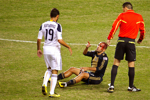 Fred bloodied against the Galaxy